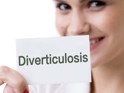 Lo Que Debes Saber Sobre la Diverticulosis